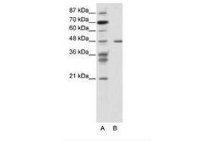 Image no. 1 for anti-Proteasome (Prosome, Macropain) 26S Subunit, ATPase, 2 (PSMC2) (N-Term) antibody (ABIN343937) (PSMC2 Antikörper  (N-Term))