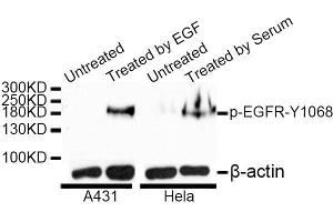 Western blot analysis of extracts of A-431 and HeLa cells, using Phospho-EGFR-Y1068 antibody. (EGFR Antikörper  (pTyr1068))