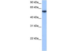 Western Blotting (WB) image for anti-Inositol-3-Phosphate Synthase 1 (ISYNA1) antibody (ABIN2463597) (ISYNA1 Antikörper)