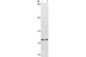 Gel: 8 % SDS-PAGE, Lysate: 40 μg, Lane 1-2: Mouse liver tissue, SP20 cells, Primary antibody: ABIN7128119(ABCB6 Antibody) at dilution 1/320, Secondary antibody: Goat anti rabbit IgG at 1/8000 dilution, Exposure time: 1 minute (ABCB6 Antikörper)