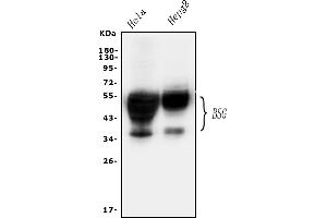 Western blot analysis of CD147/Emmprin using anti-CD147/Emmprin antibody (ABIN5518743). (CD147 Antikörper  (AA 138-323))