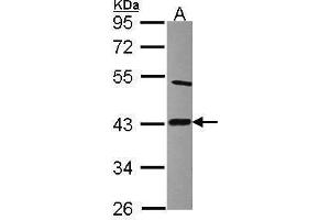 WB Image Sample (30 ug of whole cell lysate) A: Raji 10% SDS PAGE antibody diluted at 1:2000 (LIAS Antikörper)