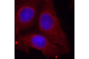 Immunofluorescence staining of methanol-fixed HeLa cells using Phospho-GAP43-S41 antibody (ABIN2988022). (GAP43 Antikörper  (pSer41))