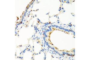 Immunohistochemistry of paraffin-embedded rat lung using RGS5 antibody at dilution of 1:100 (x40 lens). (RGS5 Antikörper)