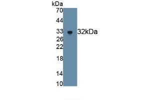 Detection of Recombinant MMP7, Human using Monoclonal Antibody to Matrix Metalloproteinase 7 (MMP7) (MMP7 Antikörper  (AA 18-267))