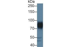 Detection of ADAM22 in Porcine Cerebrum lysate using Polyclonal Antibody to A Disintegrin And Metalloprotease 22 (ADAM22) (ADAM22 Antikörper  (AA 370-582))