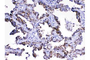 IHC analysis of Adenylosuccinate Lyase using anti-Adenylosuccinate Lyase antibody . (ASL Antikörper)