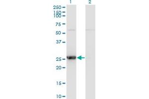 Western Blot analysis of TK1 expression in transfected 293T cell line by TK1 monoclonal antibody (M07), clone 3G10.