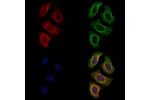 ABIN7094622 and ABIN7098672 staining Hela cells by IF/ICC. (Plexin A4 Antikörper  (C-Term))