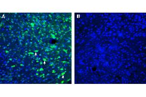 Expression of ZnT4 in mouse hypothalamus.