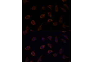 Immunofluorescence analysis of L929 cells using DUSP8 antibody (ABIN7266849) at dilution of 1:100. (DUSP8 Antikörper)