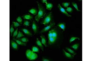 Immunofluorescence staining of A549 cells with ABIN7169157 at 1:133, counter-stained with DAPI. (PLK1 Antikörper  (AA 1-603))