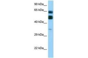 Image no. 1 for anti-Chromosome 16 Open Reading Frame 70 (C16orf70) (AA 255-304) antibody (ABIN6748108) (C16orf70 Antikörper  (AA 255-304))