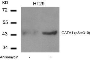Western blot analysis of extracts from HT29 cells untreated or treated with Anisomycin using GATA1(Phospho-Ser310) Antibody. (GATA1 Antikörper  (pSer310))