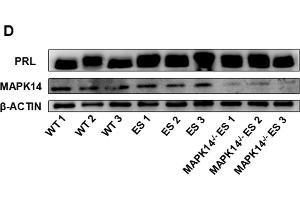 Effects of MAPK14 knockout on the development of prolactinoma in ES-induced mice. (beta Actin Antikörper)