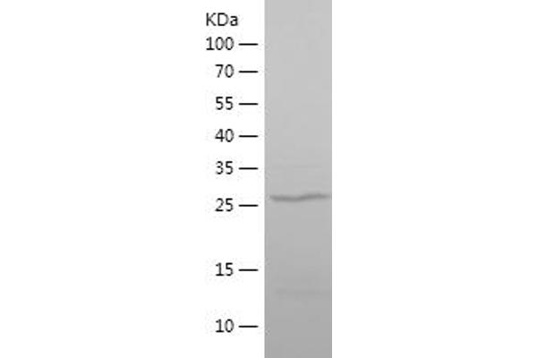 MECP2 Protein (AA 329-486) (His tag)