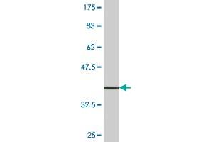 Western Blotting (WB) image for anti-ATPase, H+/K+ Exchanging, beta Polypeptide (ATP4b) (AA 67-176) antibody (ABIN513612)