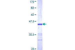 Neuregulin 2 Protein (NRG2) (AA 116-215) (GST tag)