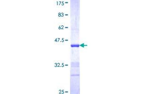 Neuregulin 2 Protein (NRG2) (AA 116-215) (GST tag)