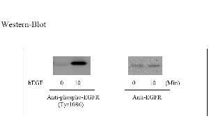 Image no. 6 for Epidermal Growth Factor Receptor (EGFR) ELISA Kit (ABIN625237) (EGFR ELISA Kit)