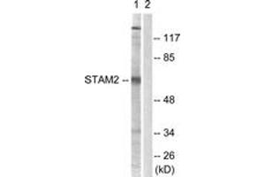 Western blot analysis of extracts from NIH-3T3 cells, treated with EGF 200ng/ml 30', using STAM2 (Ab-192) Antibody. (STAM2 Antikörper  (AA 161-210))