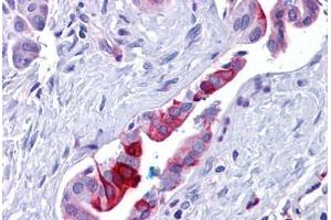 Human Pancreas, Duct: Formalin-Fixed, Paraffin-Embedded (FFPE) (Retinoblastoma Binding Protein 8 Antikörper  (Internal Region))