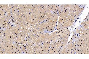 Detection of CNTFR in Porcine Cardiac Muscle Tissue using Polyclonal Antibody to Ciliary Neurotrophic Factor Receptor (CNTFR) (CNTF Receptor alpha Antikörper  (AA 120-358))
