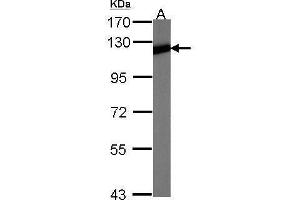 Western Blotting (WB) image for anti-Nuclear Factor of kappa Light Polypeptide Gene Enhancer in B-Cells 2 (NFKB2) (C-Term) antibody (ABIN2854310)