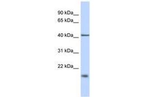 Image no. 1 for anti-TBC1 Domain Family, Member 21 (TBC1D21) (N-Term) antibody (ABIN6743256) (TBC1D21 Antikörper  (N-Term))
