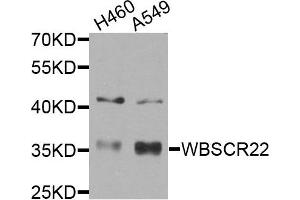 Western blot analysis of extracts of H460 and A549 cells, using WBSCR22 antibody. (WBSCR22 Antikörper)