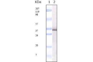 Western Blot showing SARS-E2GP3 antibody used against SARS-E2GP3 recombinant protein.