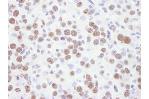 Immunohistochemistry (IHC) image for anti-Tumor Protein P53 Binding Protein 1 (TP53BP1) (AA 350-400) antibody (ABIN7448396)