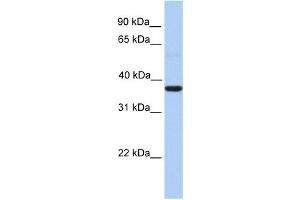 WB Suggested Anti-ZC3H15 Antibody Titration:  0. (ZC3H15 Antikörper  (Middle Region))