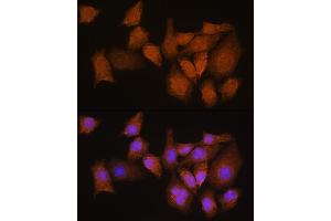 Immunofluorescence analysis of HeLa cells using NMN Rabbit pAb (ABIN7268910) at dilution of 1:100.