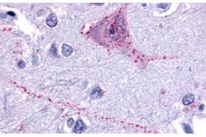 Anti-TACR3 antibody  ABIN1049391 IHC staining of human brain, neurons and glia. (TACR3 Antikörper  (N-Term))