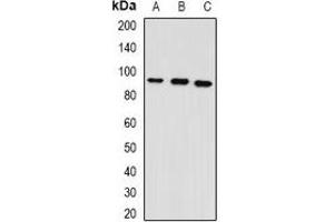 Western blot analysis of GPAM expression in mouse heart (A), mouse lung (B), rat brain (C) whole cell lysates. (GPAM Antikörper)