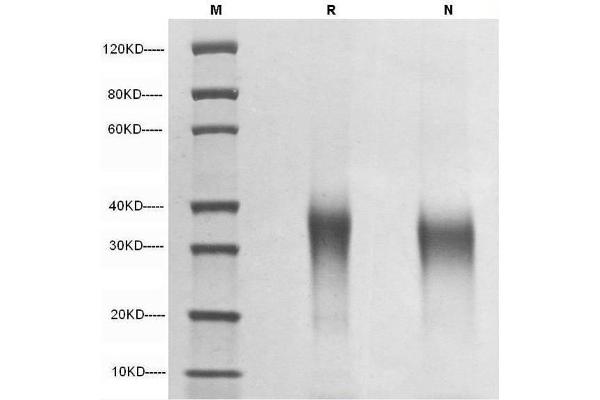 EPO Protein (AA 28-193)