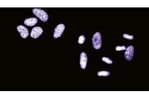 Immunofluorescent staining of HeLa cells. (SSB Antikörper  (AA 179-289))