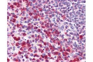 Immunohistochemistry (IHC) image for anti-Transforming Growth Factor, beta 1 (TGFB1) (Middle Region) antibody (ABIN2780306)