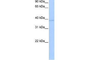 WB Suggested Anti-ANXA8L2 Antibody Titration:  0. (ANXA8L2 Antikörper  (N-Term))