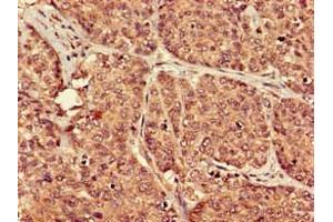 Immunohistochemistry (IHC) image for anti-Prostaglandin E Receptor 3 (Subtype EP3) (PTGER3) (AA 1-49) antibody (ABIN7164854)