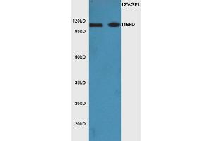 L1 mouse brain lysate L2 mouse heart lysates probed with Anti Phospho-ATG1(Ser556)Polyclonal Antibody, Unconjugated  at 1:3000 for 90 min at 37˚C. (ULK1 Antikörper  (pSer556))
