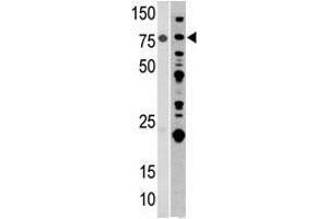 Image no. 1 for anti-Aconitase 2, Mitochondrial (ACO2) (Center) antibody (ABIN357262)