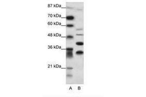 Image no. 1 for anti-Growth Factor Independent 1 (GFI1) (N-Term) antibody (ABIN6736088) (GFI1 Antikörper  (N-Term))