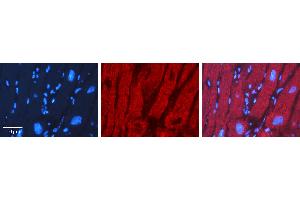 Immunohistochemistry (IHC) image for anti-X-Box Binding Protein 1 (XBP1) (N-Term) antibody (ABIN2780640)