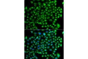 Immunofluorescence analysis of A549 cells using ZFYVE1 antibody (ABIN5975594). (ZFYVE1 Antikörper)