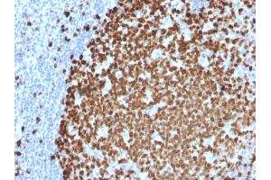 Formalin-fixed, paraffin-embedded human Tonsil stained with Ki67 Mouse Monoclonal Antibody (MKI67/2461). (Ki-67 Antikörper  (AA 2293-2478))