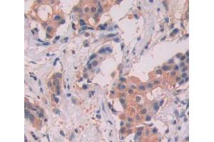 Used in DAB staining on fromalin fixed paraffin- embedded breast tissue (MYH11 Antikörper  (AA 162-315))