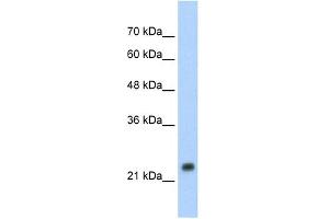 WB Suggested Anti-HSPB1 Antibody Titration: 1. (HSP27 Antikörper  (C-Term))