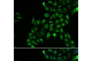 Immunofluorescence analysis of U2OS cells using TSPAN7 Polyclonal Antibody (Tetraspanin 7 Antikörper)